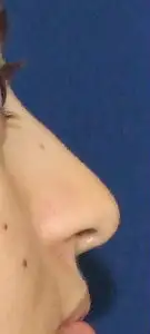 öncek.webp