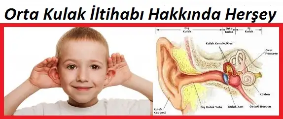 Orta-Kulak-İltihabı-Hakkında-Herşey.webp