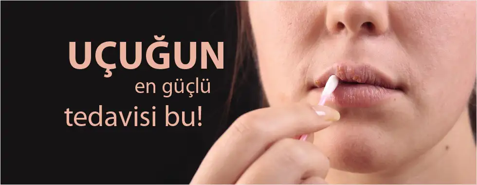 ozellikle-ucuga-iyi-geliyor-5317973.webp