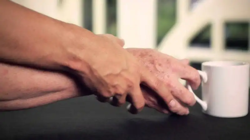 parkinson-ve-tms.webp