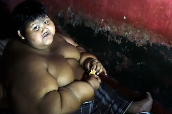 pay-arya-permana-worlds-fattest-child_10704489085774fc1a339b2.webp