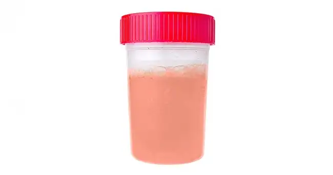 pembe_ve_kirmizi_idrar_rengi.webp