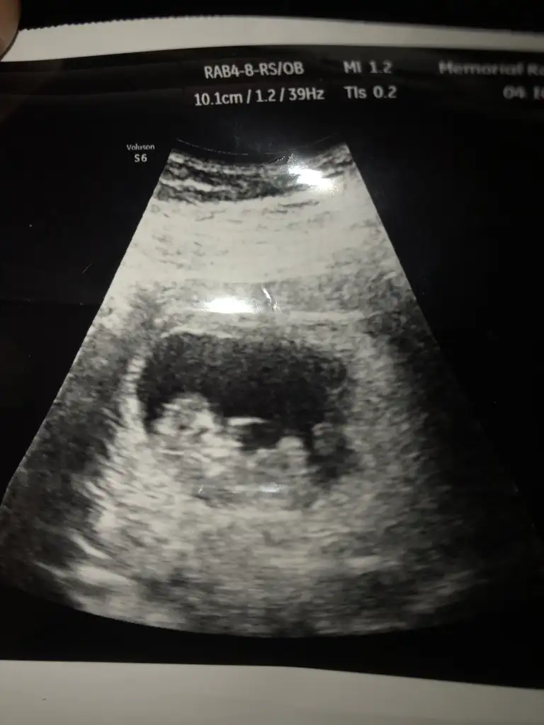 Photo 7.10.2019 20 03 15.webp