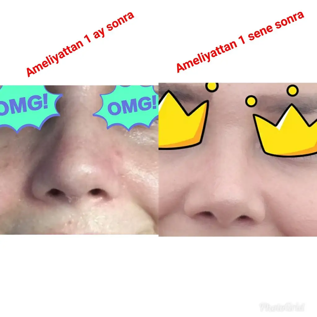 2285394