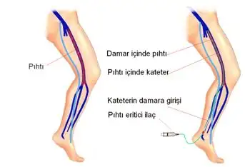 pihti.webp