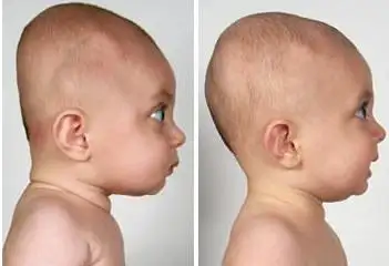 plagiobaby.webp