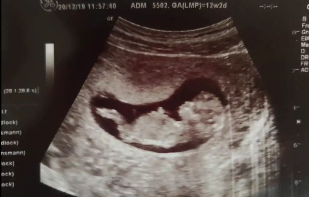 Screen Shot 2019-12-23 at 11.23.38.webp