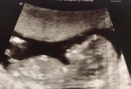 Screen Shot 2019-12-23 at 11.23.56.webp