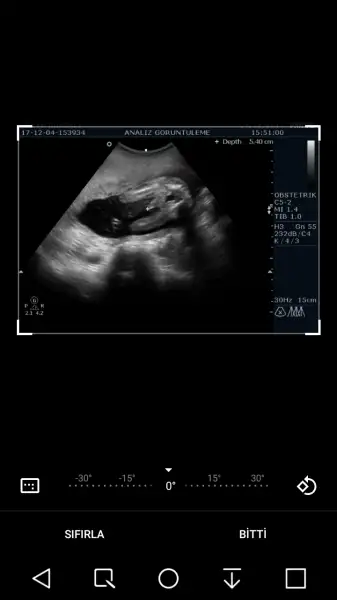 Screenshot_2017-12-04-23-51-08.webp