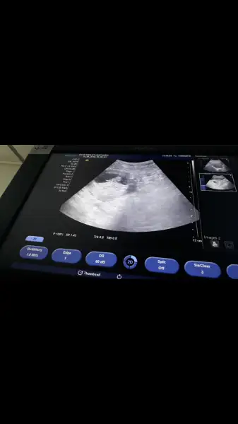 Screenshot_20180814-154857.webp