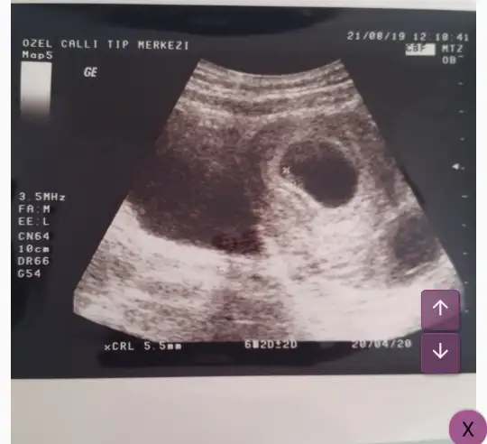 Screenshot_2019-08-24-11-16-38-1.webp