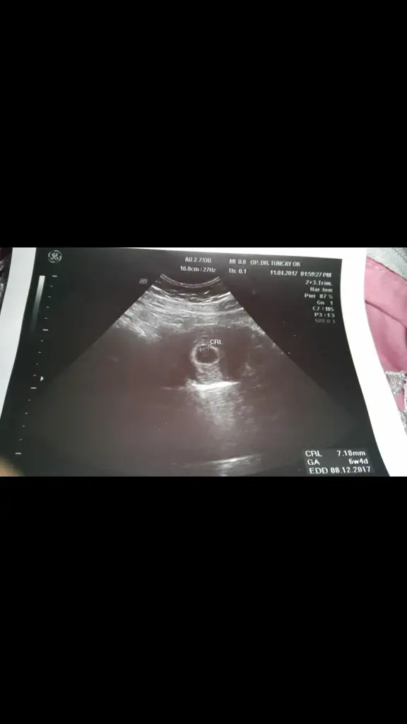 Screenshot_2019-12-29-19-02-45.webp