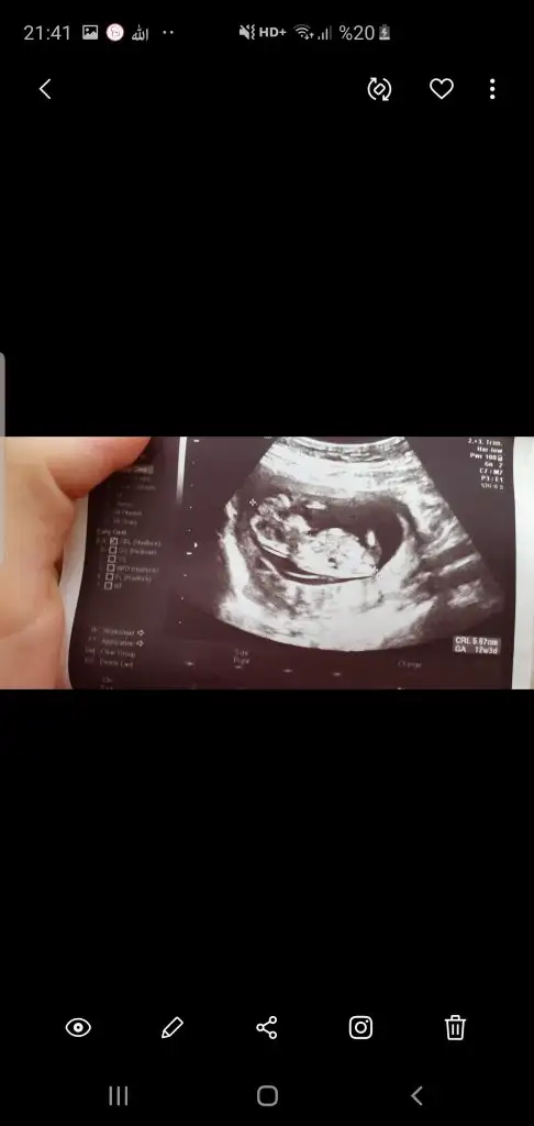 Screenshot_20191029-214118_Gallery.webp