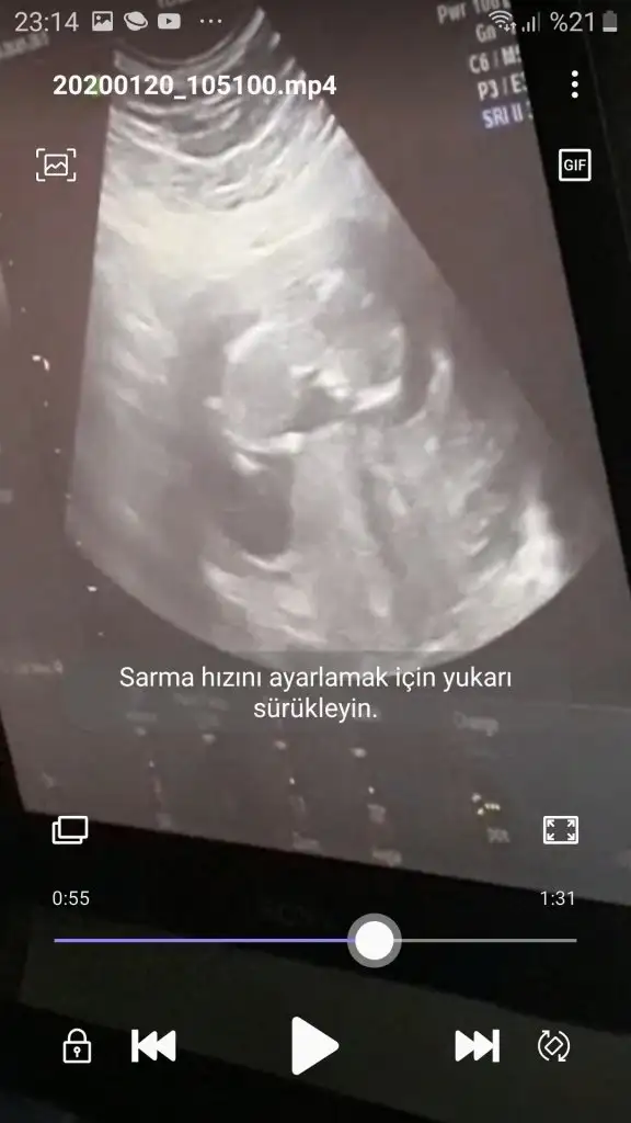 Screenshot_20200124-231500_Video Player.webp