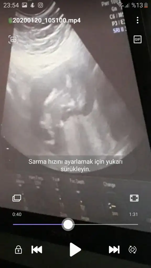 Screenshot_20200124-235403_Video Player.webp