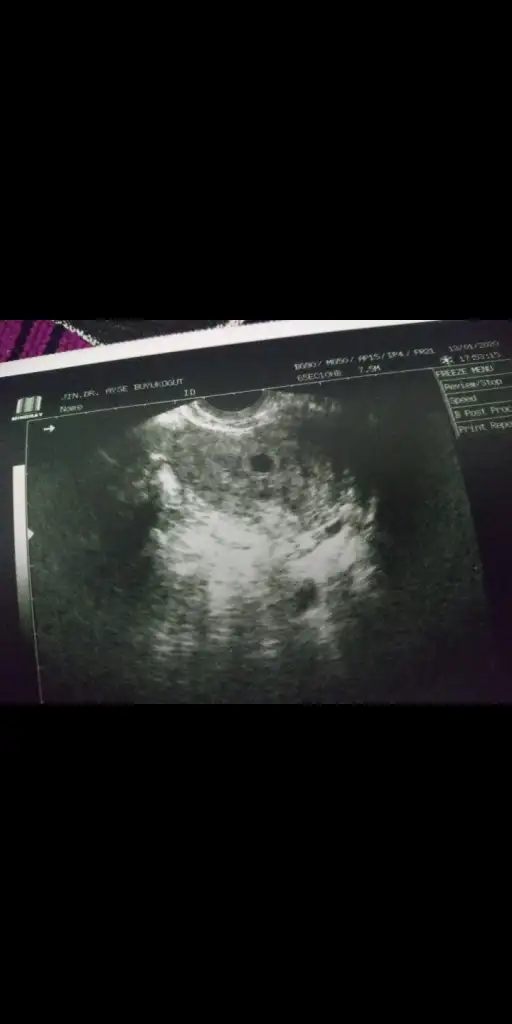 Screenshot_20200407-115427.webp