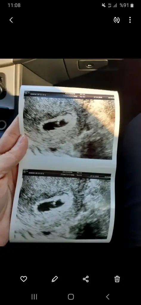 Screenshot_20201117-110805_Gallery.webp