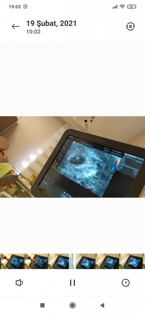 Screenshot_2021-03-01-19-03-16-966_com.miui.videoplayer.webp