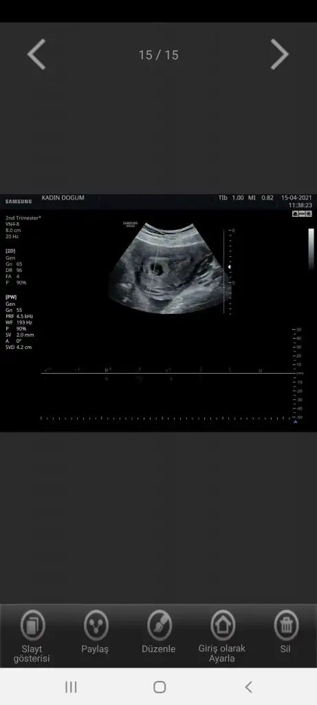 Screenshot_20210529-112455_Hello Mom.webp