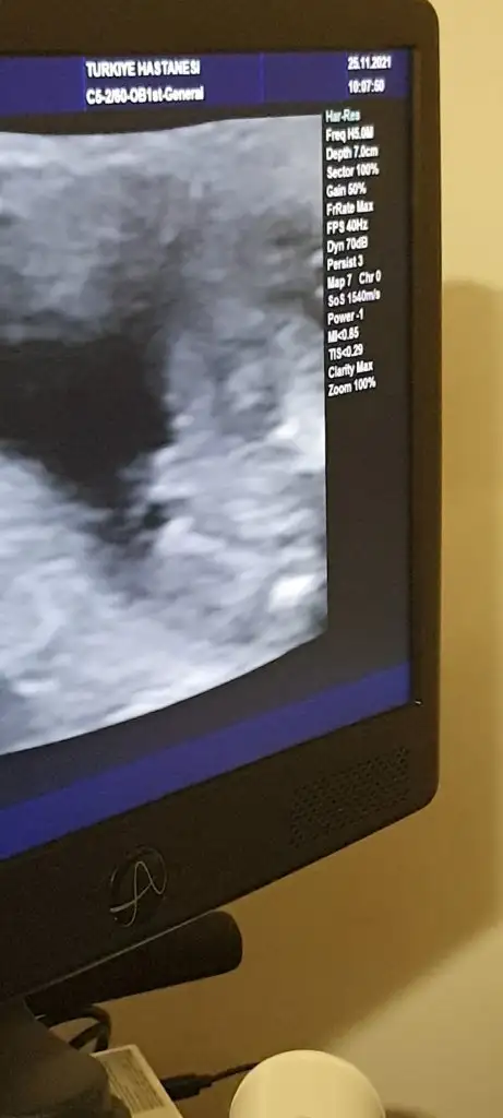 Screenshot_20211204-132329_Video Player.webp