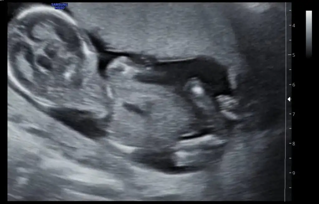 Screenshot_20220111_130943.webp