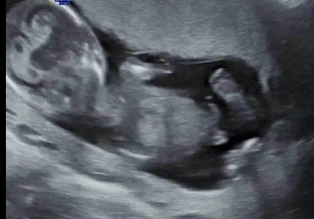 Screenshot_20220111_131011.webp