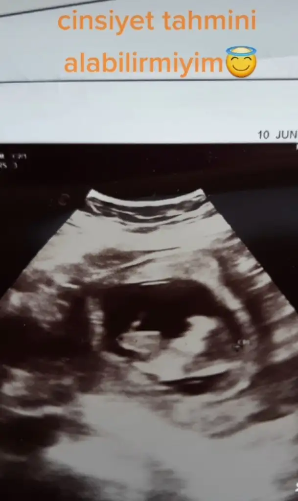 Screenshot_20220610-171414_TikTok.webp