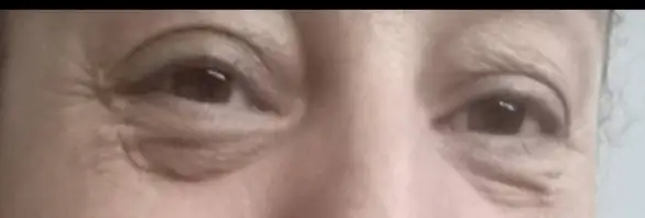 Screenshot_20220822-180453_Photos.webp