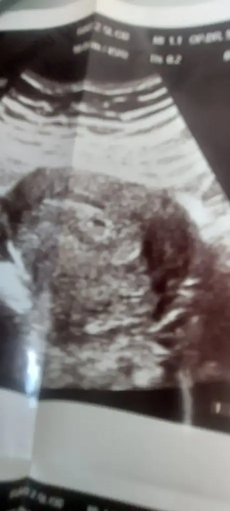 Screenshot_20221012-170336_Gallery.webp