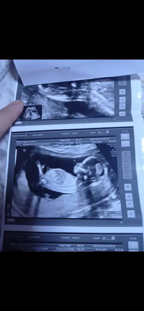 Screenshot_2023-10-31-00-33-11-464_com.miui.gallery.webp