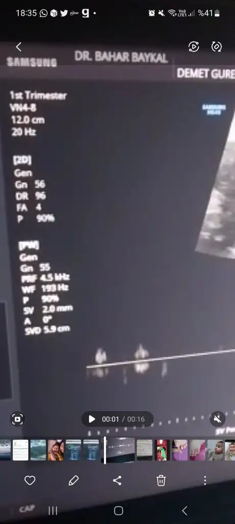 Screenshot_20230201_183503_Gallery.webp