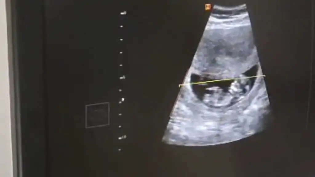 Screenshot_20230619_154716_Gallery.webp