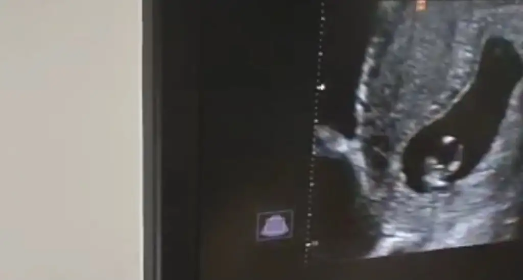 Screenshot_20230619_154817_Gallery.webp