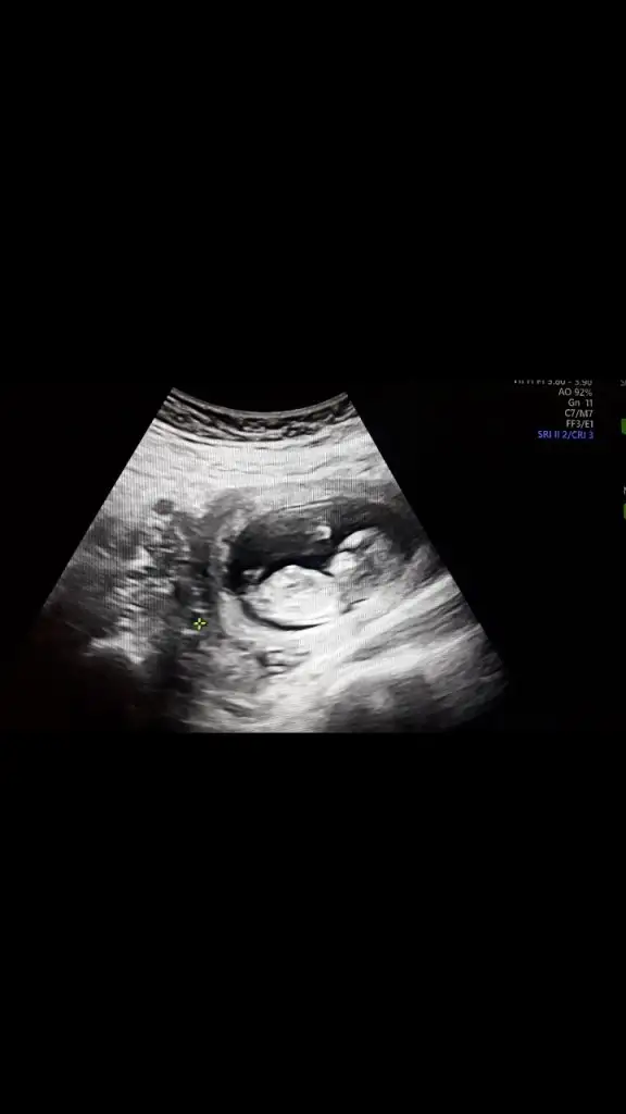 Screenshot_20240211-140140_Gallery.webp