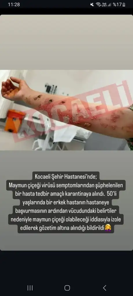 Screenshot_20240817_112834_Instagram.webp