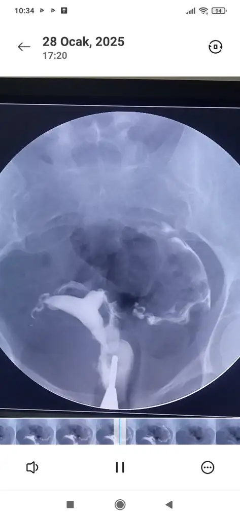 Screenshot_2025-02-14-10-34-37-517_com.miui.videoplayer.webp