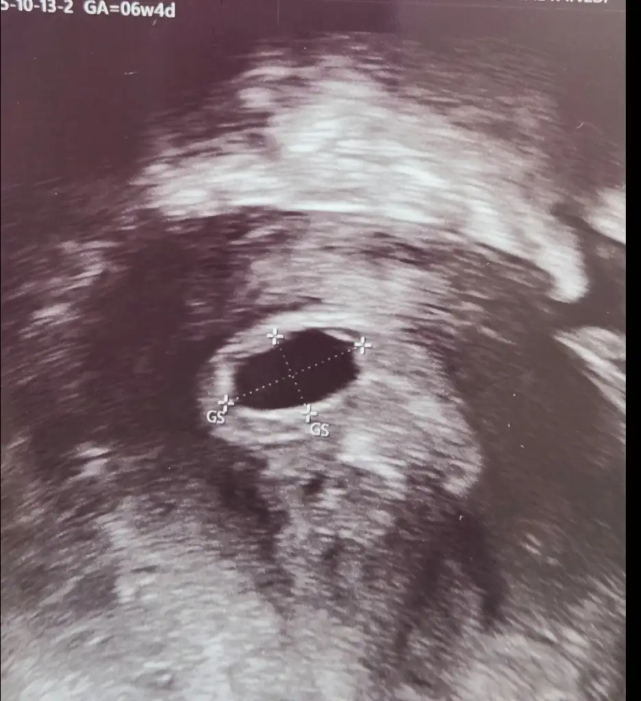 Screenshot_20251015_164456_Photo Editor.webp