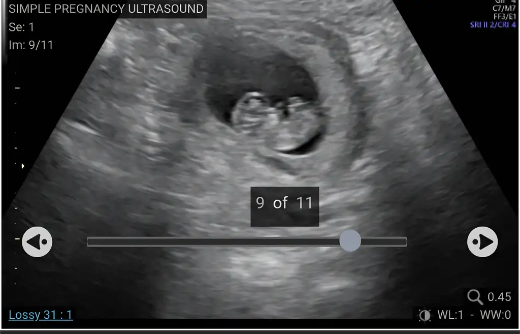 Screenshot_20260920_094009_Chrome.webp