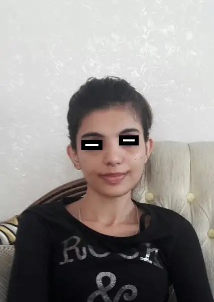 sonrası.webp