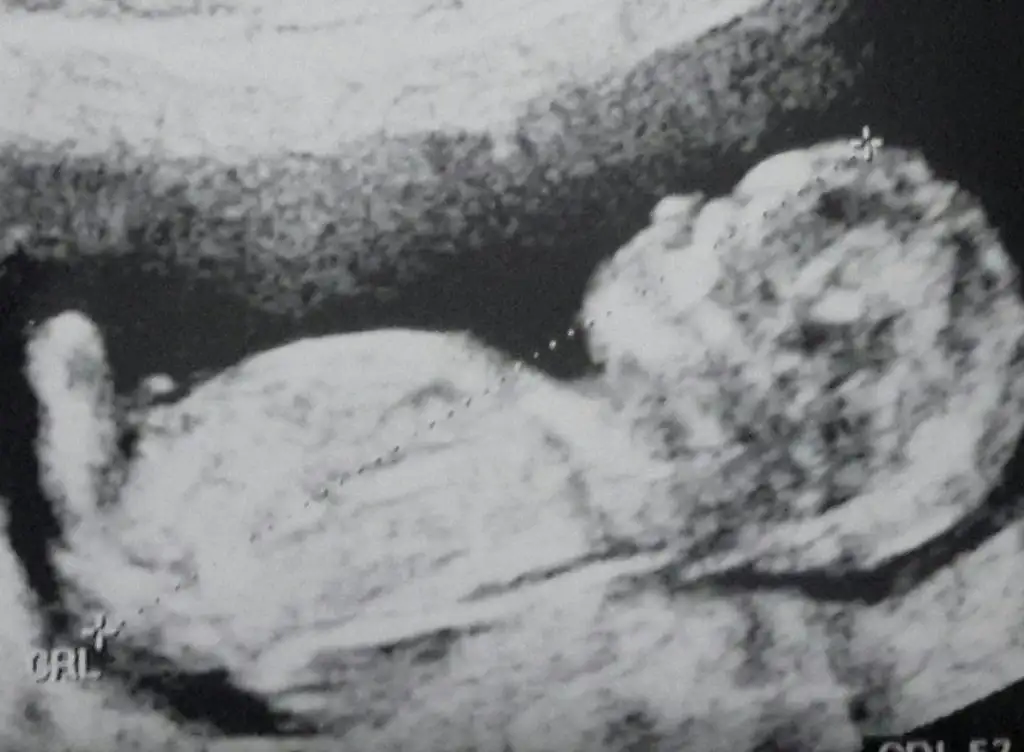 Studio_20150411_164352-1 (1).webp