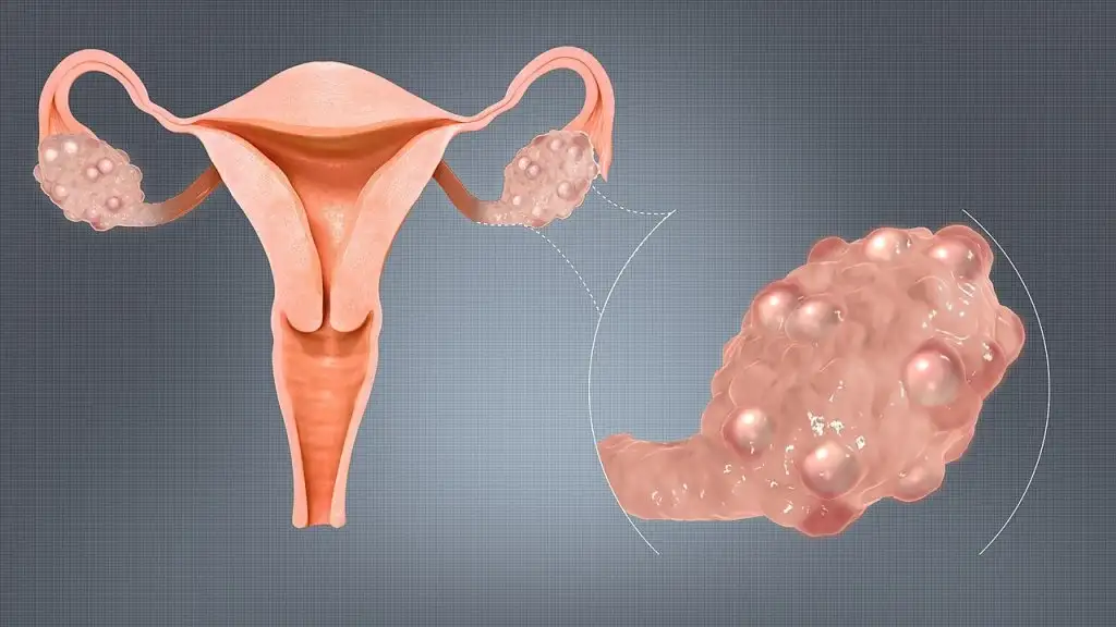 subfertilite nedir, ne demek