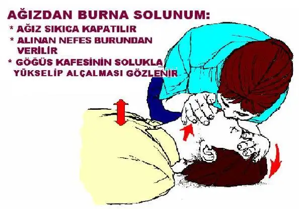 sunc4b0solunum.webp