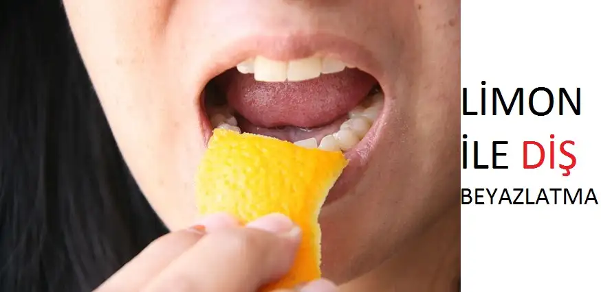 Teeth-Whitening-Tips-2.webp