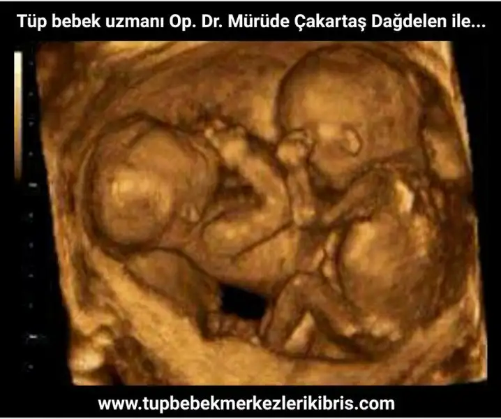 tup-bebek.webp