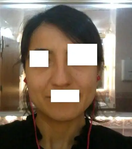 vfd.webp