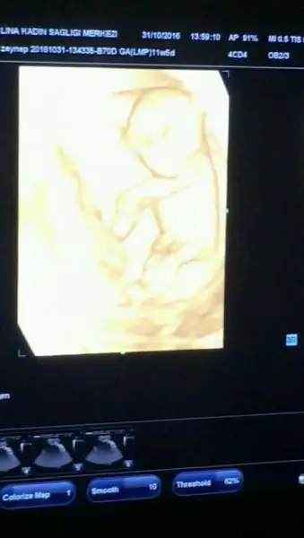 VID-20161031-WA0008_0000035061_1.webp