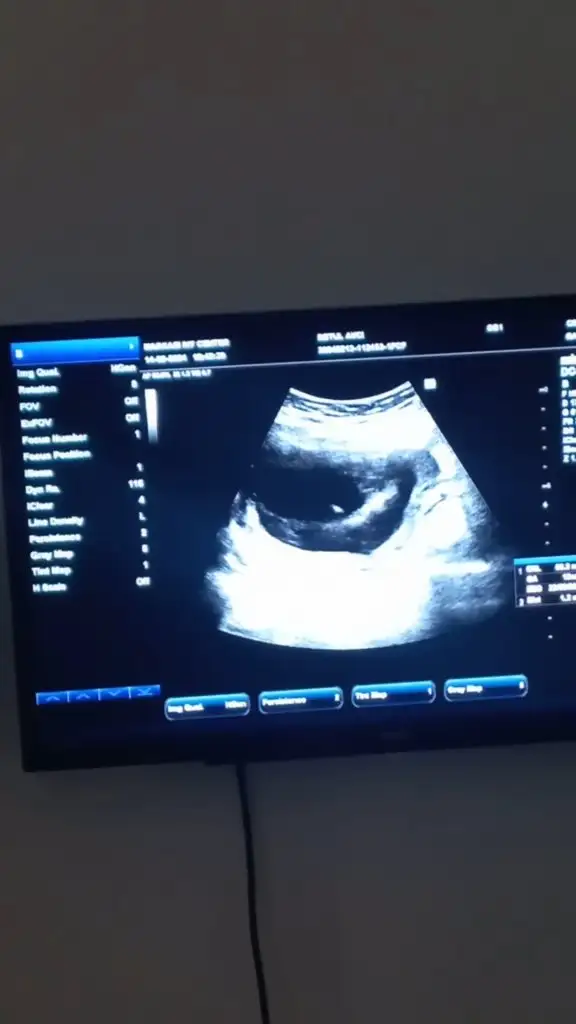 VideoCapture_20240215-194454.jpg