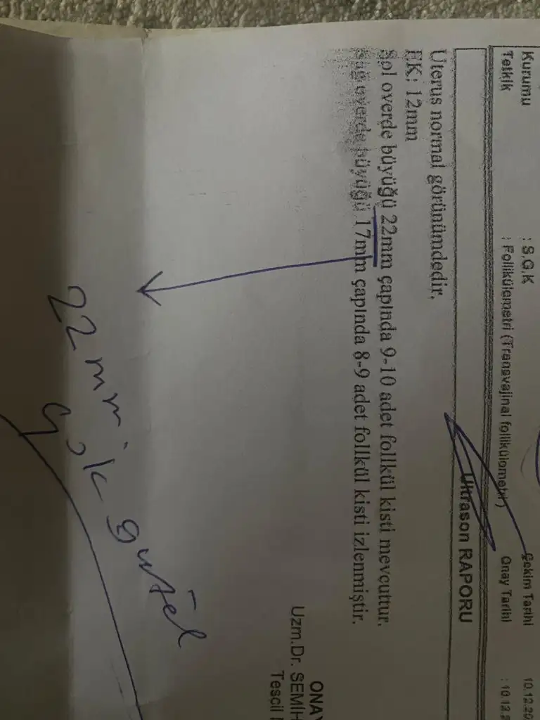 WhatsApp Görsel 2024-12-25 saat 15.03.09_488a0d73.webp