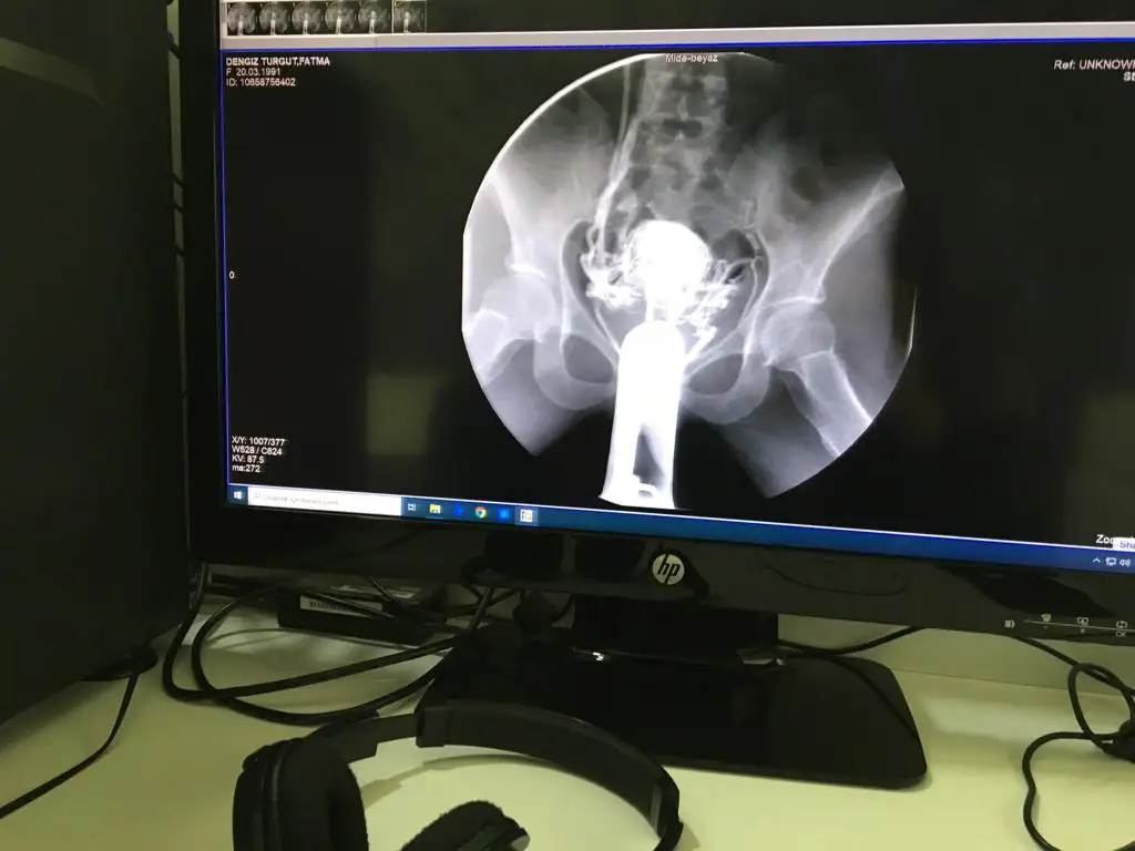 WhatsApp Image 2019-09-06 at 13.08.00.webp