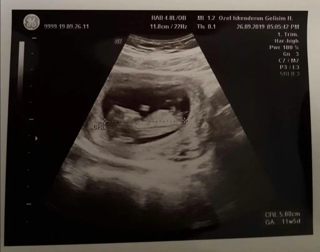 WhatsApp Image 2019-09-26 at 15.21.54.webp